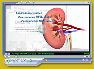 Corporate Video Presentation for Oncura by Dynamic Digital Advertising